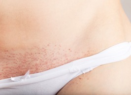 Do razor bumps plague your complexion after every shave? 