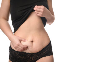 A postpartum woman pinching loose skin on her stomach and considering CoolTone®