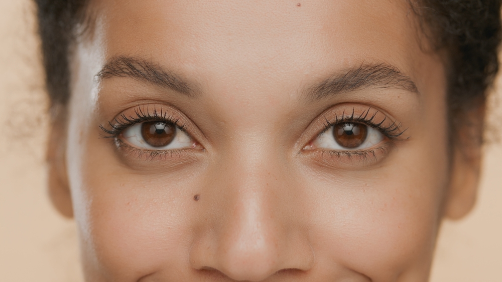 A close-up shot of hollows under a woman's eyes